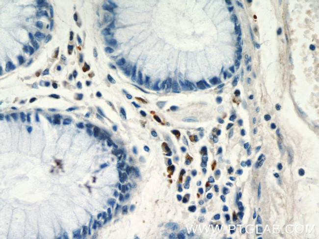 CCL17 Antibody in Immunohistochemistry (Paraffin) (IHC (P))