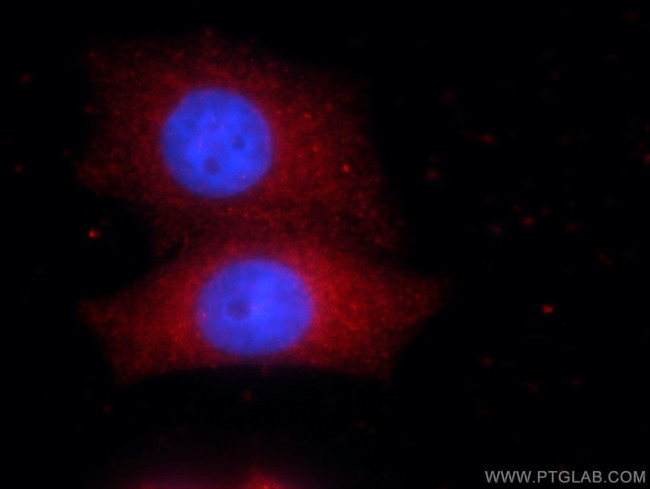 TBX2 Antibody in Immunocytochemistry (ICC/IF)