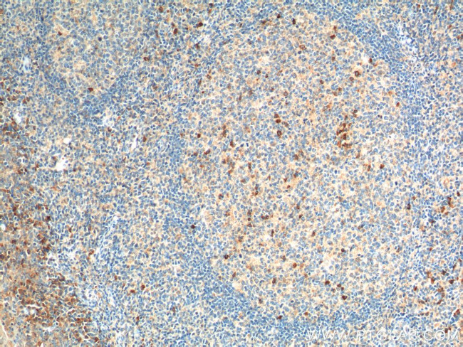 CCR3 Antibody in Immunohistochemistry (Paraffin) (IHC (P))