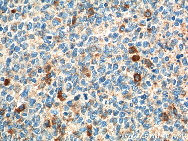 CCR3 Antibody in Immunohistochemistry (Paraffin) (IHC (P))