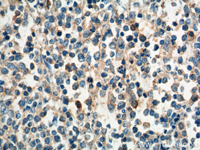 CCR3 Antibody in Immunohistochemistry (Paraffin) (IHC (P))