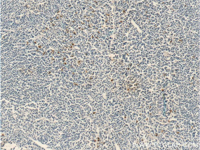 CCR3 Antibody in Immunohistochemistry (Paraffin) (IHC (P))