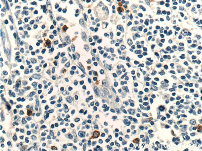 CCR3 Antibody in Immunohistochemistry (Paraffin) (IHC (P))