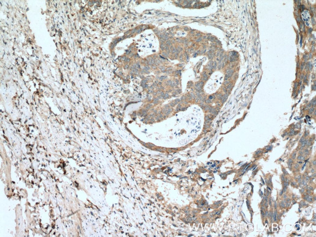 MIG Antibody in Immunohistochemistry (Paraffin) (IHC (P))