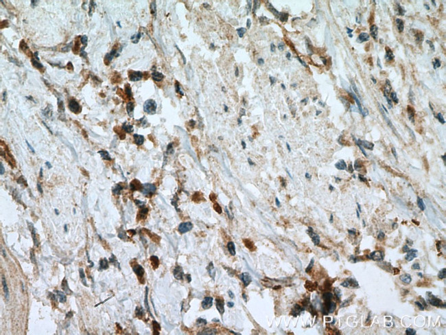 MIG Antibody in Immunohistochemistry (Paraffin) (IHC (P))