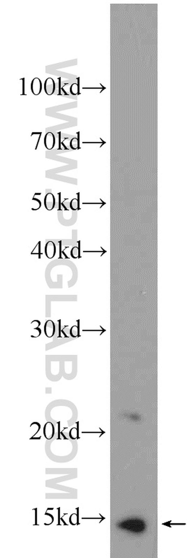 MIG Antibody in Western Blot (WB)