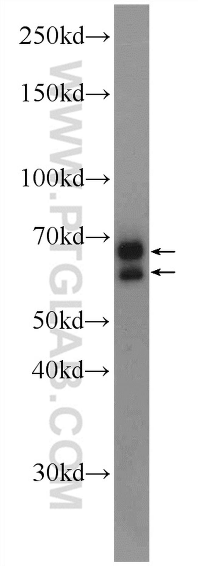 CXorf15 Antibody in Western Blot (WB)