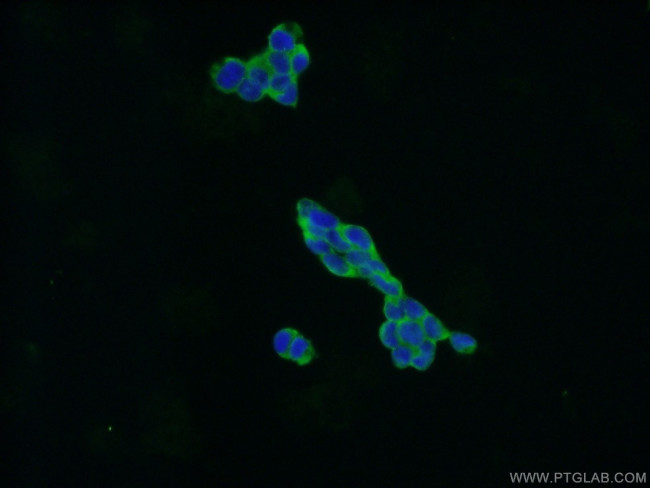 CXorf15 Antibody in Immunocytochemistry (ICC/IF)