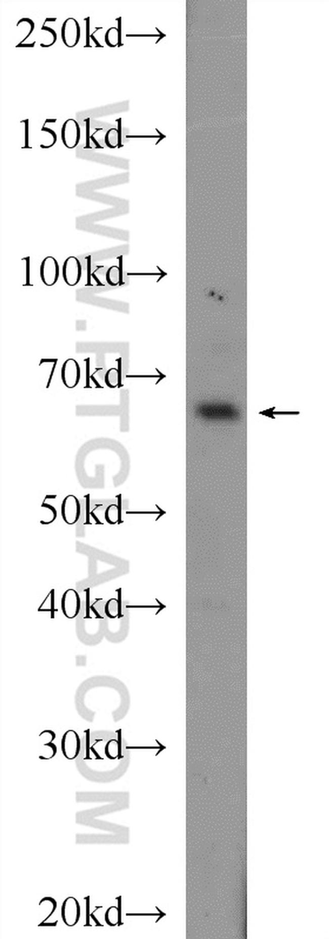 CXorf15 Antibody in Western Blot (WB)