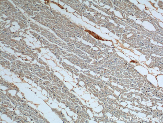 ATP2A1 Antibody in Immunohistochemistry (Paraffin) (IHC (P))