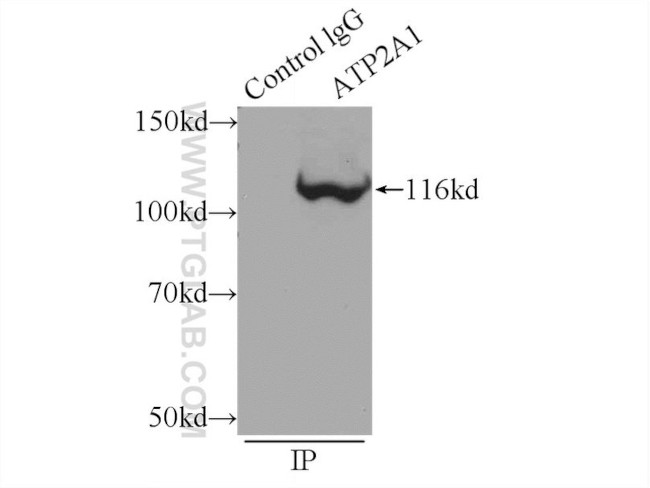 ATP2A1 Antibody in Immunoprecipitation (IP)