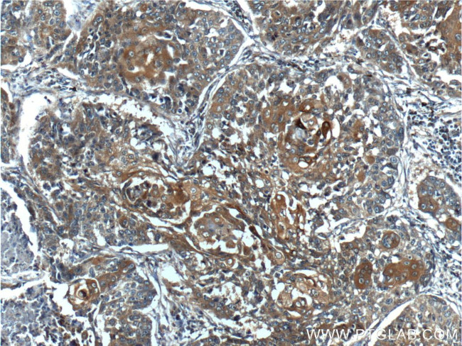 BRCA1 Antibody in Immunohistochemistry (Paraffin) (IHC (P))