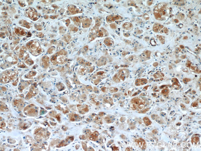 BRCA1 Antibody in Immunohistochemistry (Paraffin) (IHC (P))