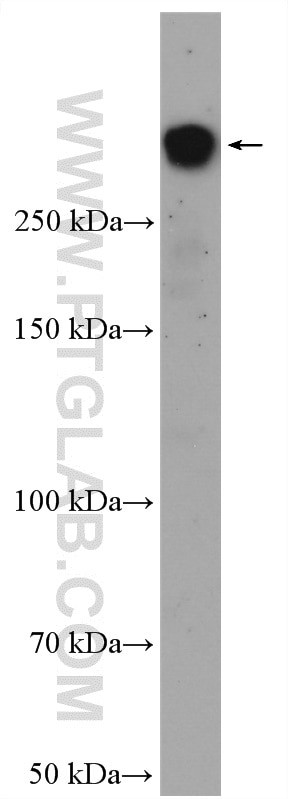 BRCA1 Antibody in Western Blot (WB)