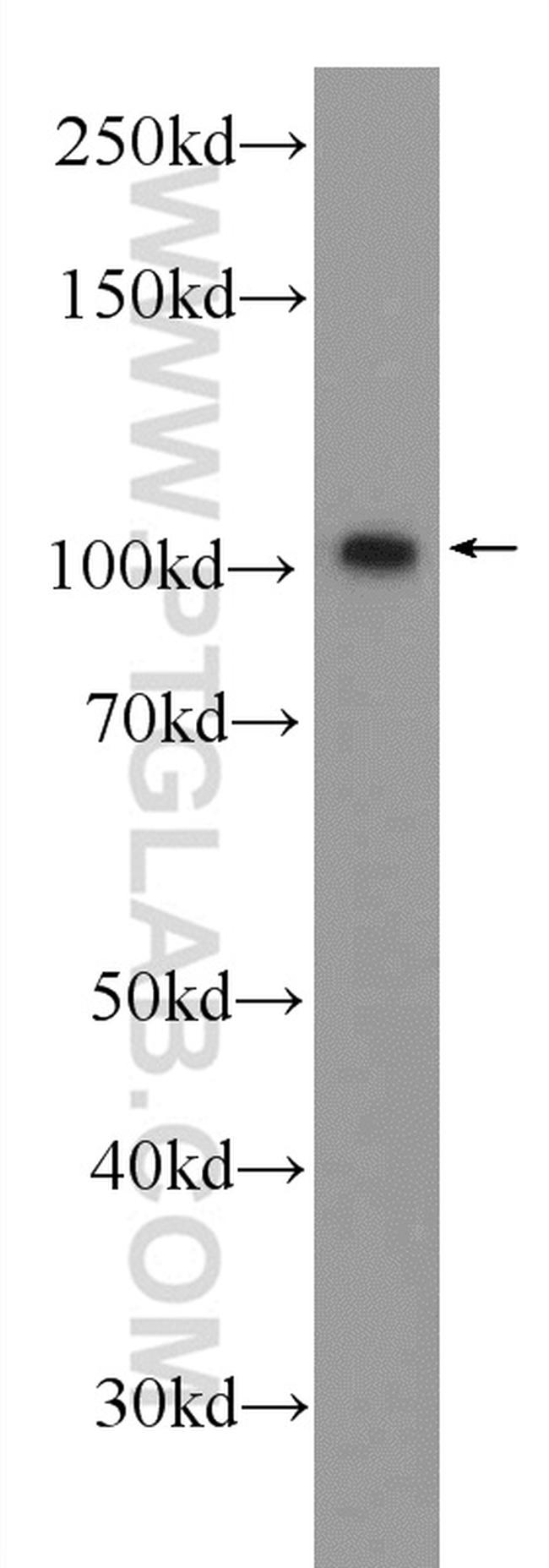 BRCA1 Antibody in Western Blot (WB)