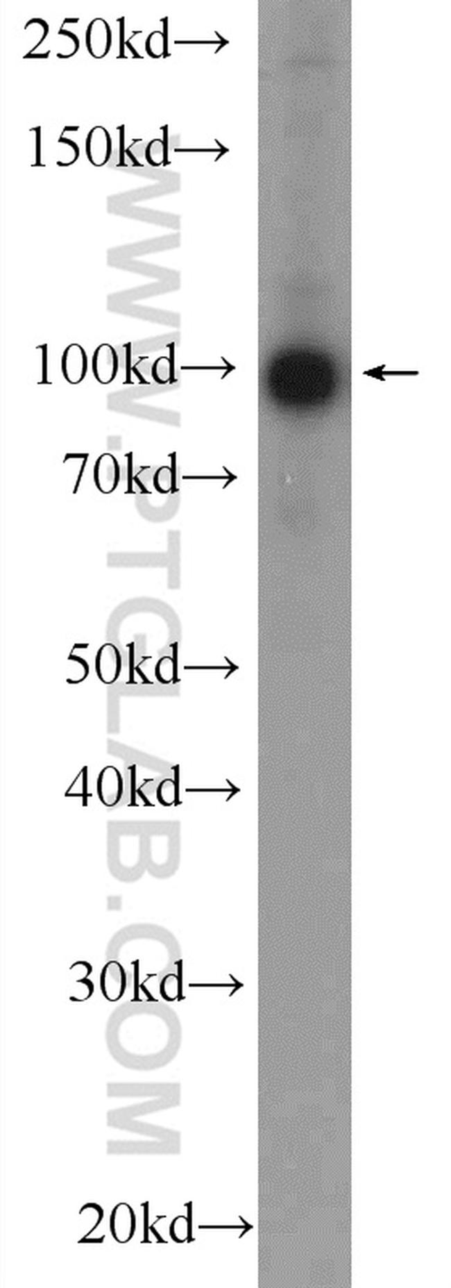 BRCA1 Antibody in Western Blot (WB)