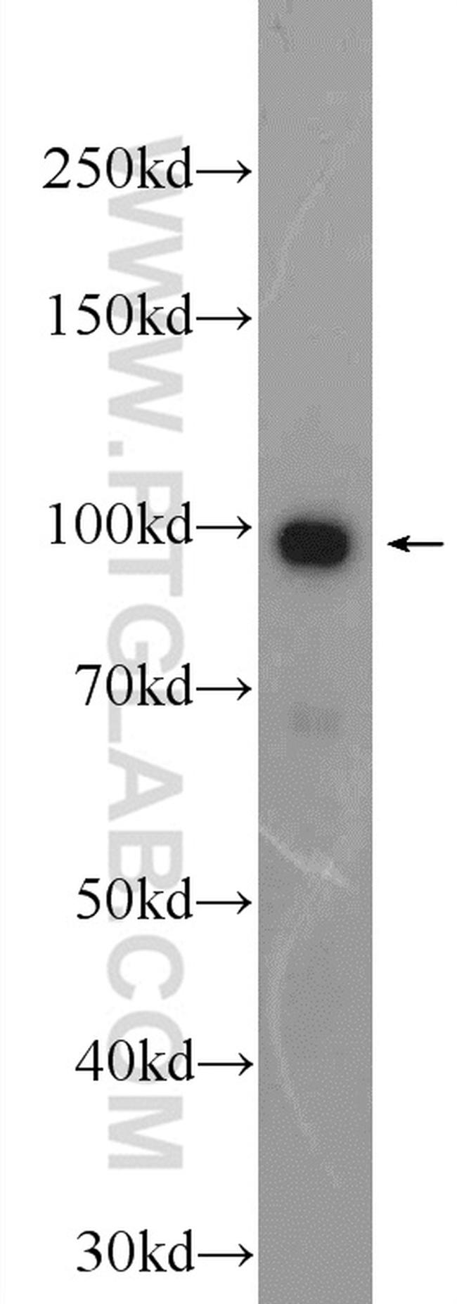 BRCA1 Antibody in Western Blot (WB)