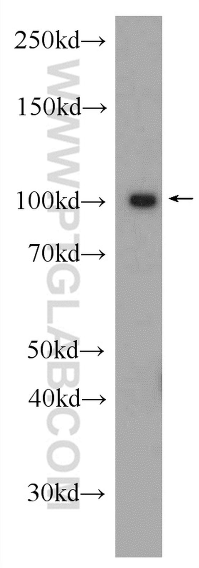 BRCA1 Antibody in Western Blot (WB)