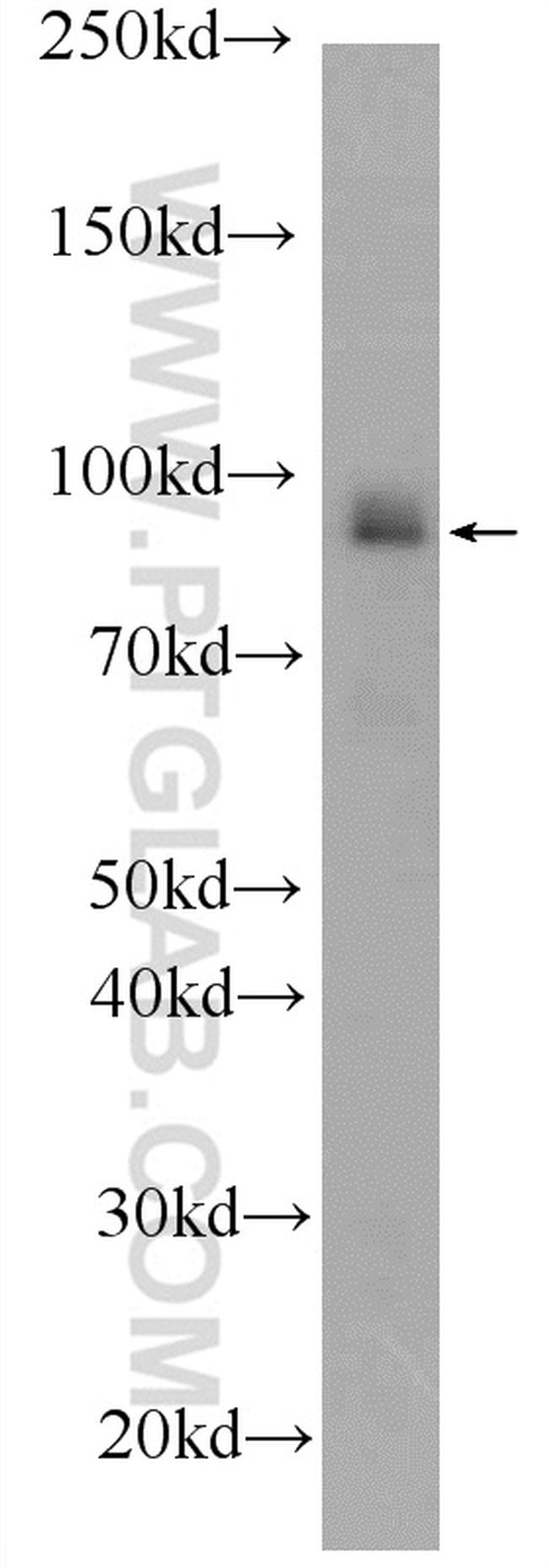 BRCA1 Antibody in Western Blot (WB)