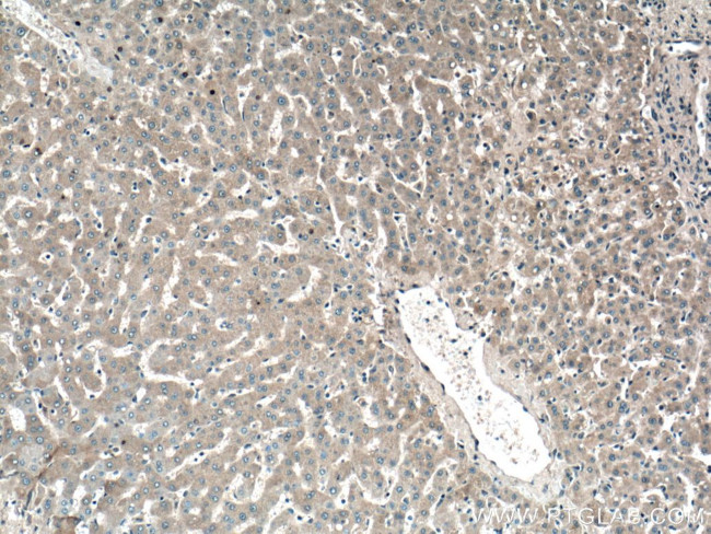 GYS2 Antibody in Immunohistochemistry (Paraffin) (IHC (P))