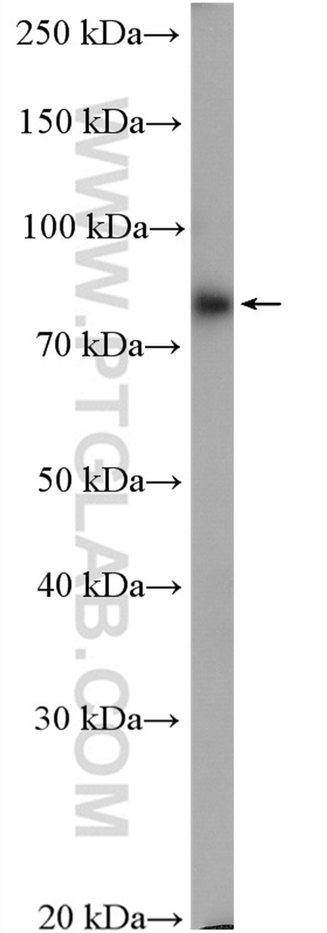 GYS2 Antibody in Western Blot (WB)