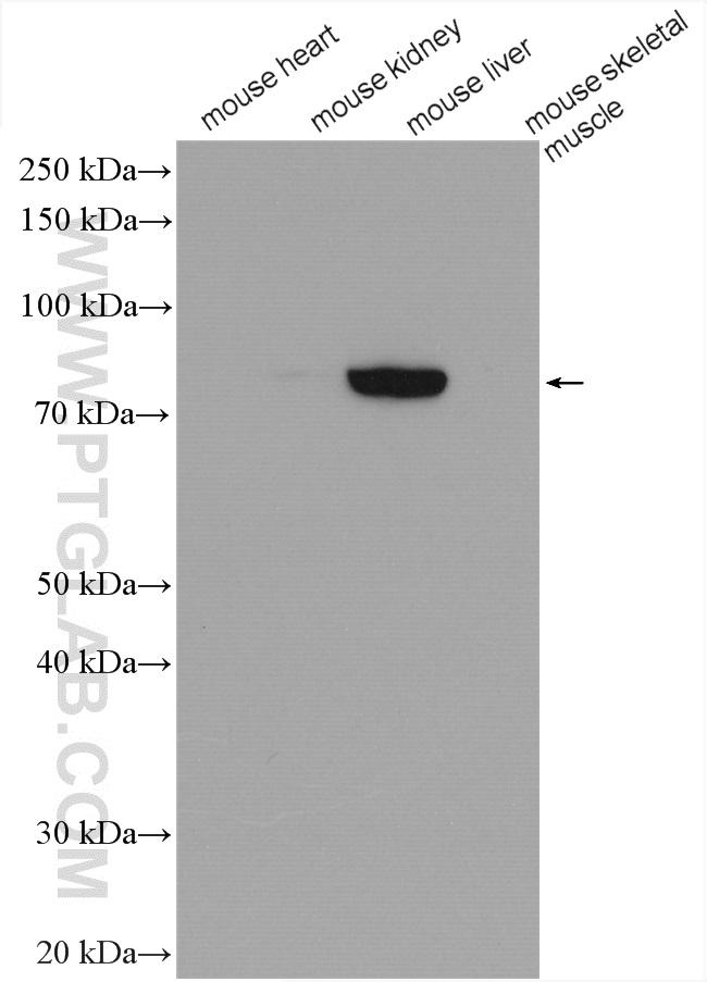 GYS2 Antibody in Western Blot (WB)