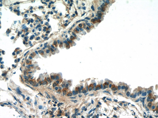 DCP1A Antibody in Immunohistochemistry (Paraffin) (IHC (P))