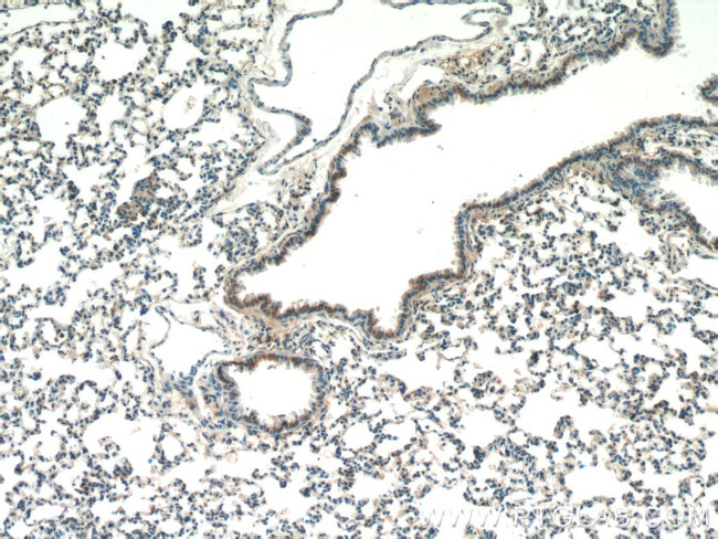 DCP1A Antibody in Immunohistochemistry (Paraffin) (IHC (P))