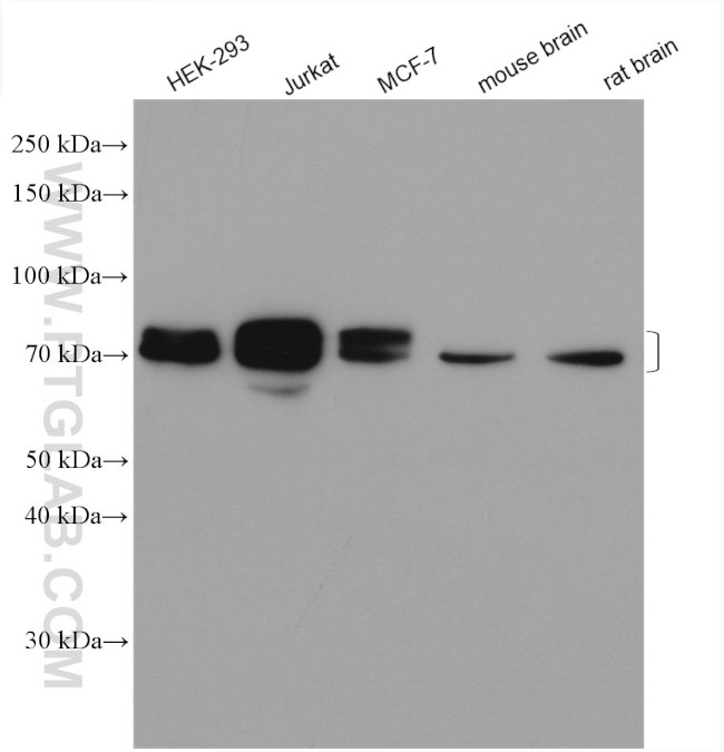 DCP1A Antibody in Western Blot (WB)