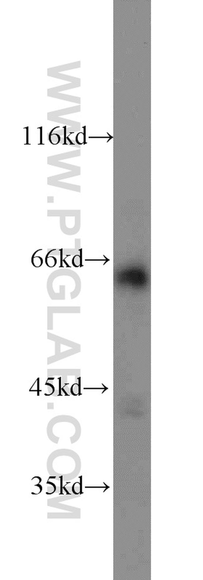 DCP1A Antibody in Western Blot (WB)