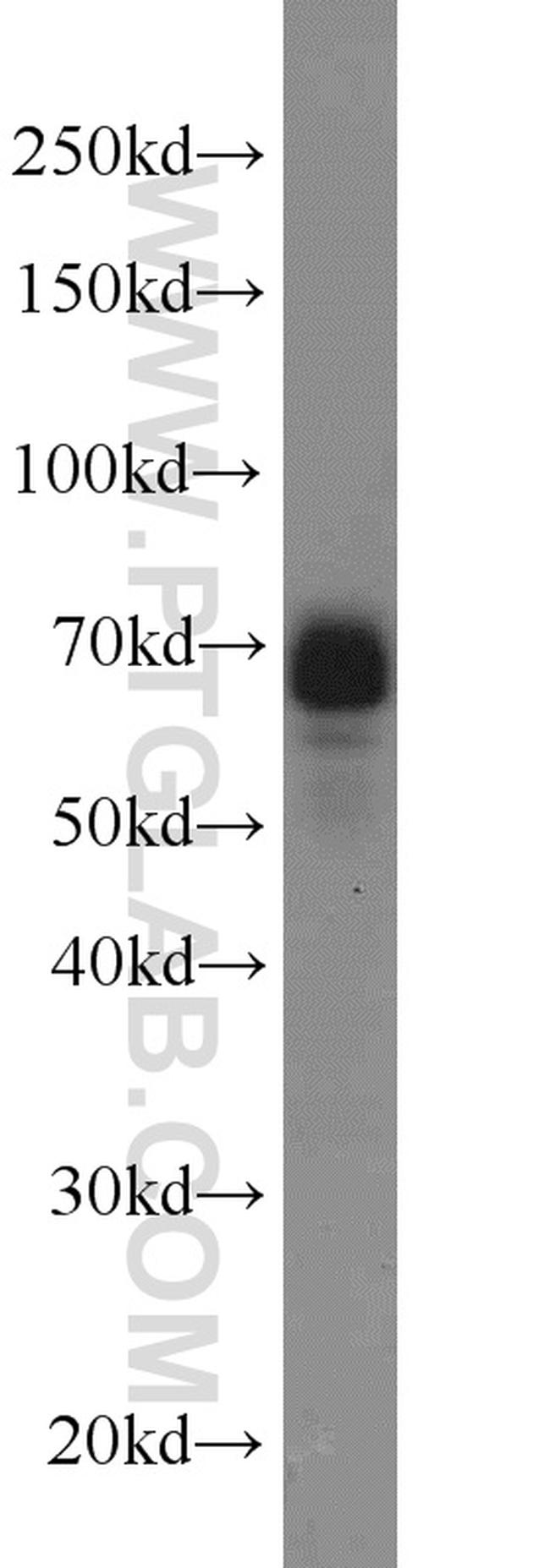 DCP1A Antibody in Western Blot (WB)