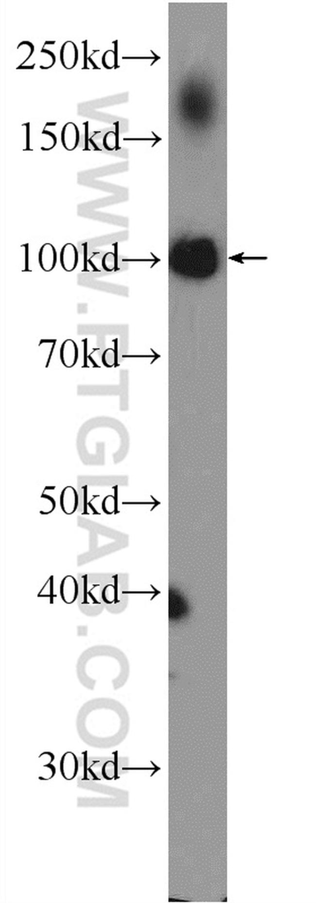 PPARGC1B Antibody in Western Blot (WB)