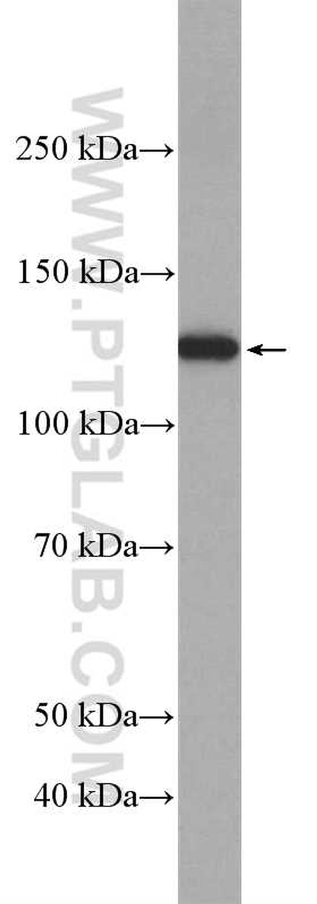 LRIG1 Antibody in Western Blot (WB)