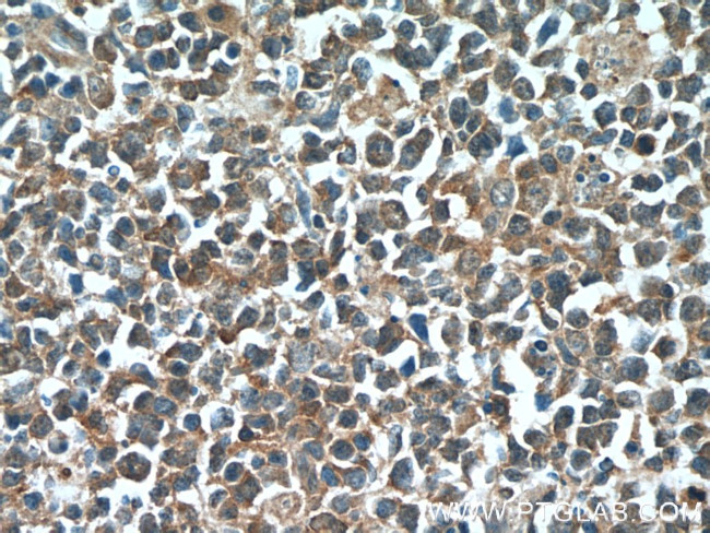 IRF7 Antibody in Immunohistochemistry (Paraffin) (IHC (P))