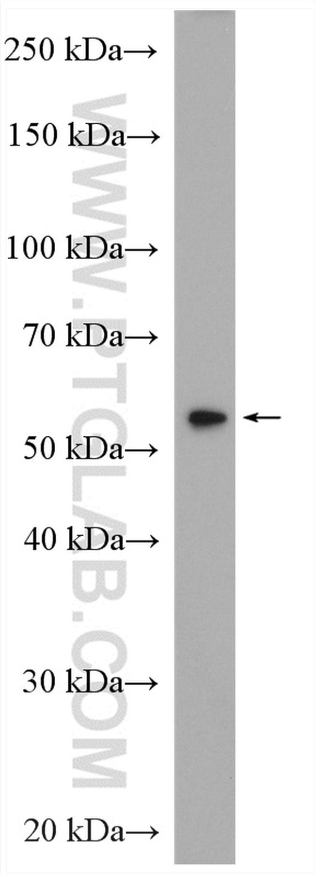 IRF7 Antibody in Western Blot (WB)