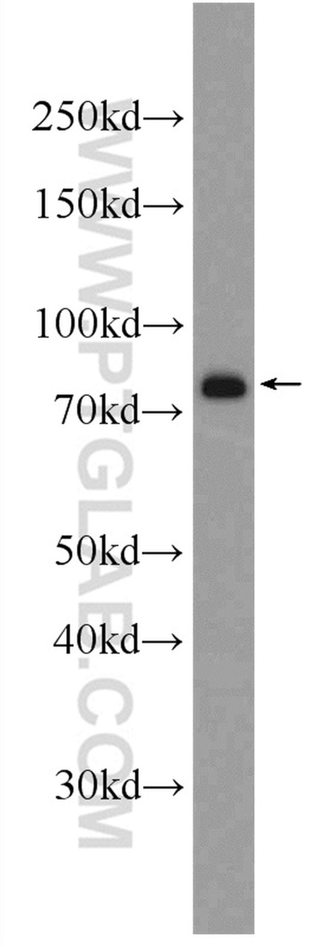 IRF7 Antibody in Western Blot (WB)