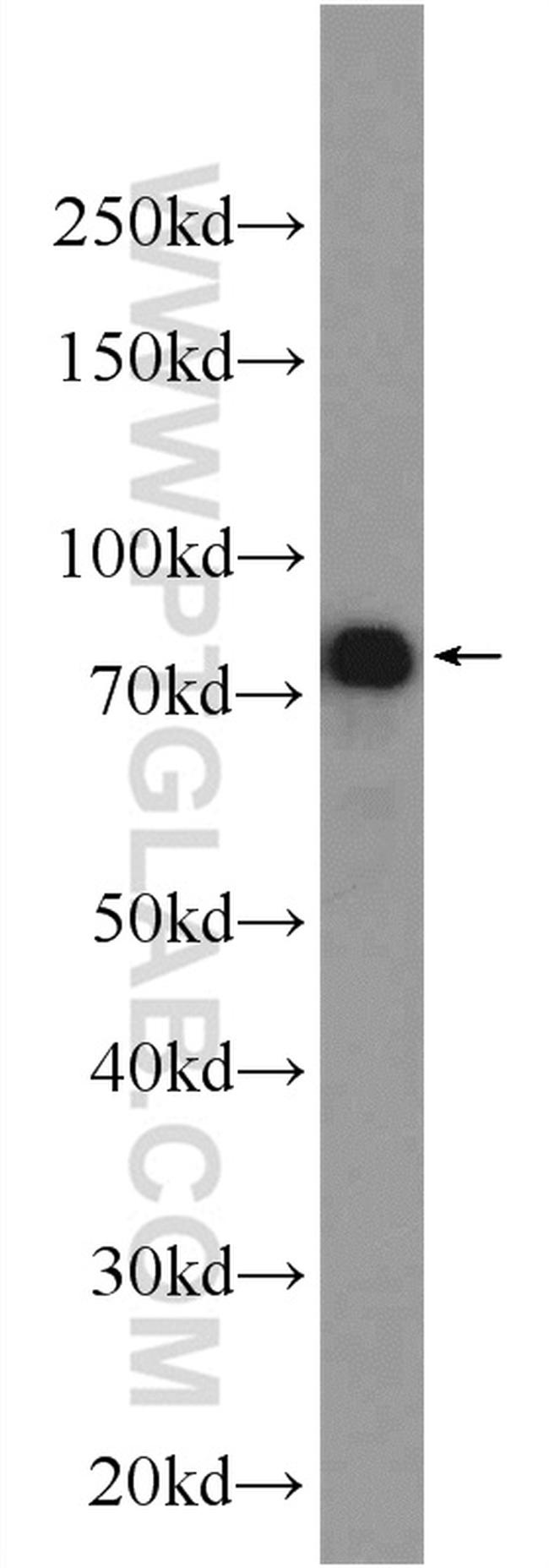 IRF7 Antibody in Western Blot (WB)