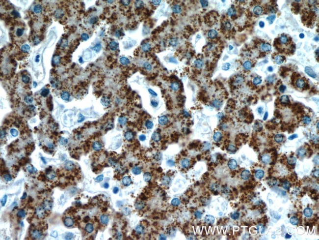 AGXT Antibody in Immunohistochemistry (Paraffin) (IHC (P))