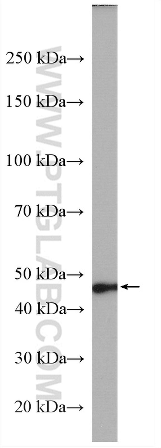 AGXT Antibody in Western Blot (WB)