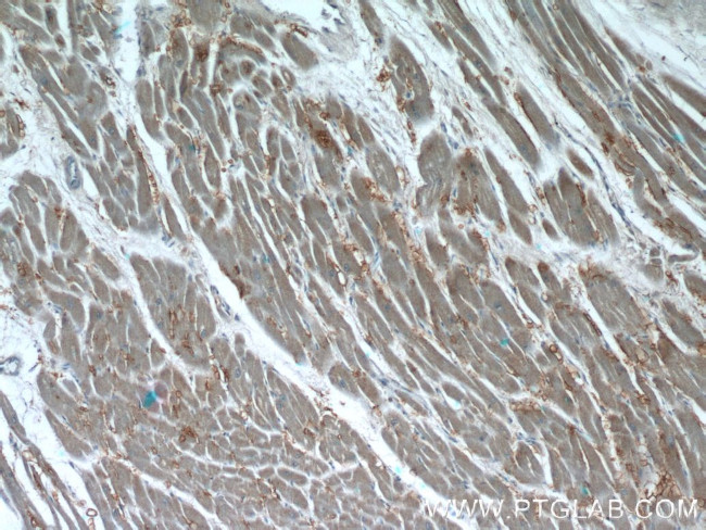 Syntenin-1 Antibody in Immunohistochemistry (Paraffin) (IHC (P))