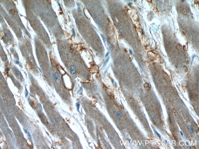 Syntenin-1 Antibody in Immunohistochemistry (Paraffin) (IHC (P))