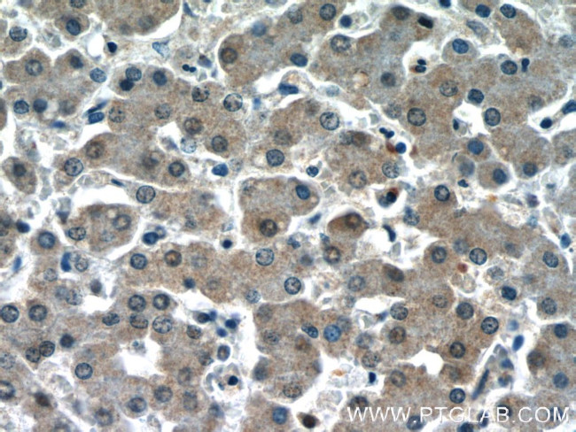 Syntenin-1 Antibody in Immunohistochemistry (Paraffin) (IHC (P))