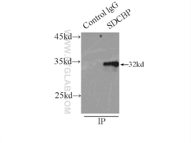 Syntenin-1 Antibody in Immunoprecipitation (IP)