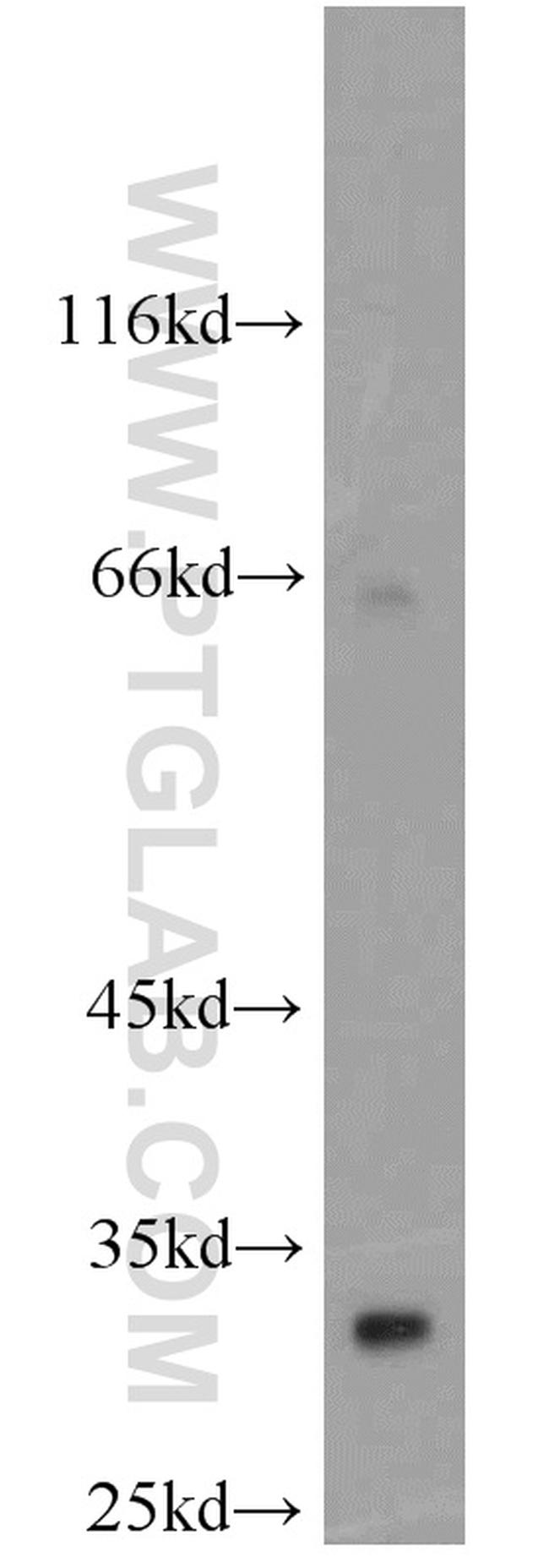 Syntenin-1 Antibody in Western Blot (WB)