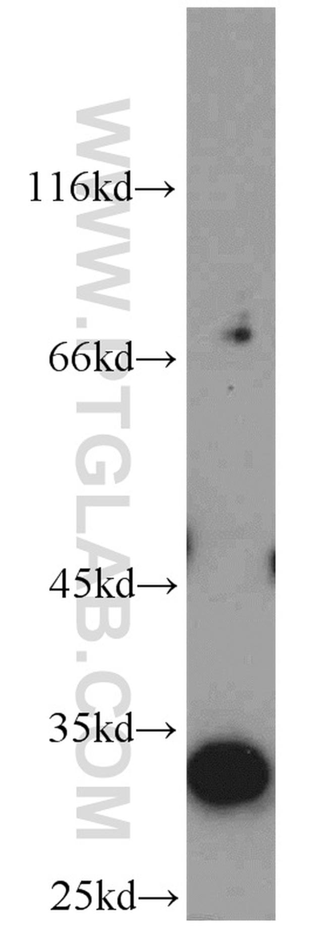 Syntenin-1 Antibody in Western Blot (WB)