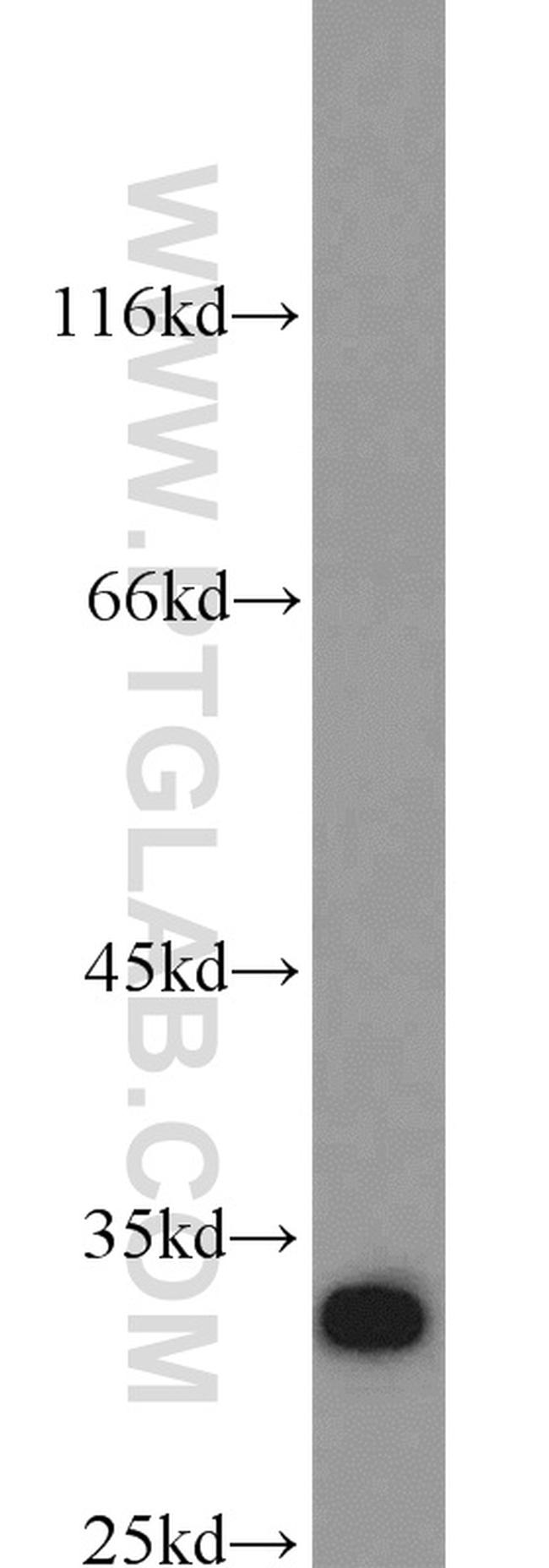 Syntenin-1 Antibody in Western Blot (WB)