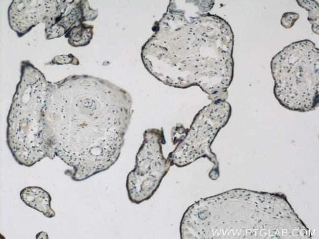 ACSL4/FACL4 Antibody in Immunohistochemistry (Paraffin) (IHC (P))