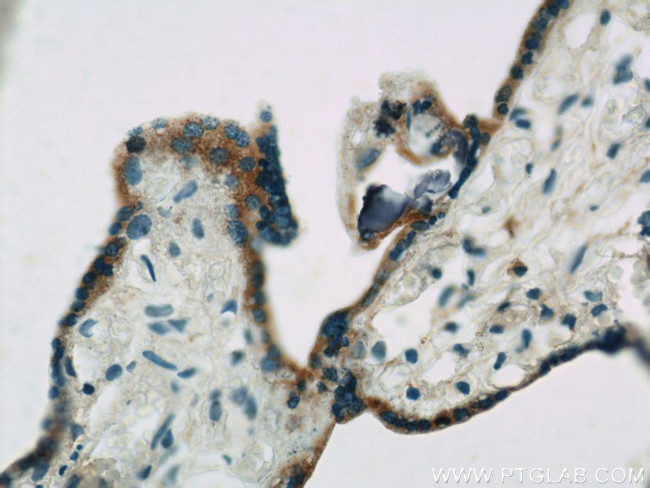 ACSL4/FACL4 Antibody in Immunohistochemistry (Paraffin) (IHC (P))