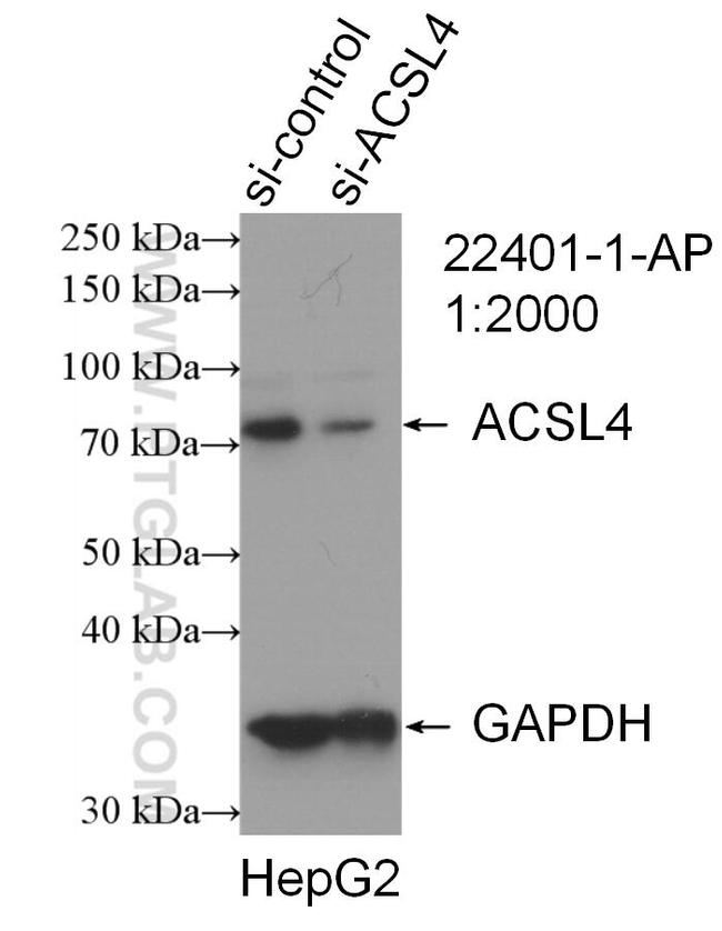 ACSL4/FACL4 Antibody in Western Blot (WB)