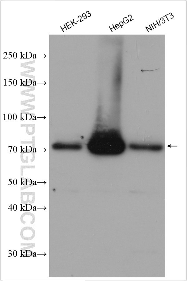 ACSL4/FACL4 Antibody in Western Blot (WB)